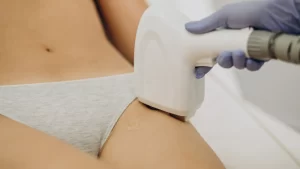 Genital Bölge Lazer Epilasyon - Zararlı Mı? - genital bölge ve lazer