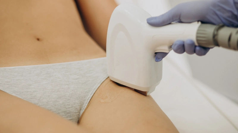 Genital Bölge Lazer Epilasyon - Zararlı Mı? - genital bölge ve lazer