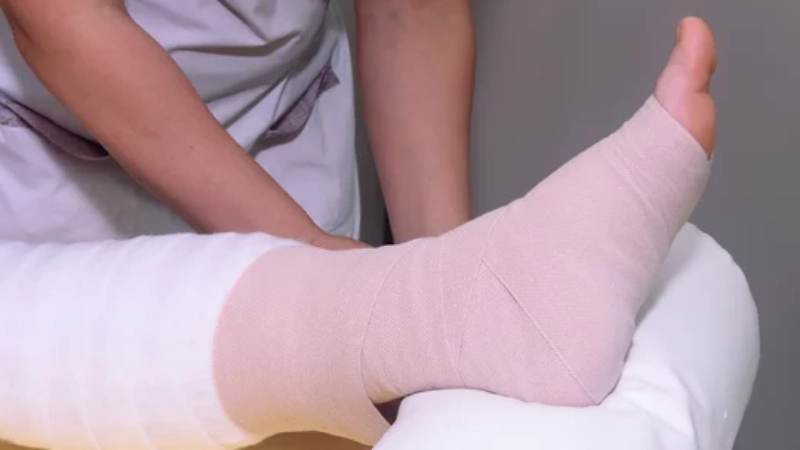 Lenfödem Belirtileri - Nasıl Teşhis Edilir? - lenfödem afişi