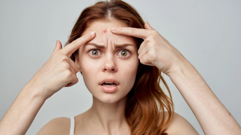 Sivilce ve Siyah Noktalardan Kurtulun- yüzünde sivilce olan kız