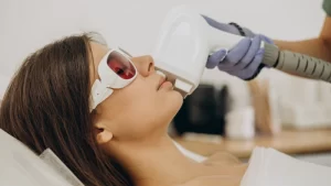 Yüz İçin Lazer Epilasyon - yüzüne lazer yaptıran kadın