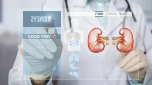 Böbrek Nakli: Sık Sorulan Sorular - böbrek nakli