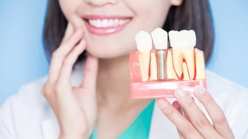 Kemik Grefti Nedir? - implant ve çene bağlantısını gösteren resim