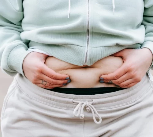 Obezite Nedenleri- obez ve göbeğini tutan kadın