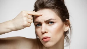 forehead lowering surgery