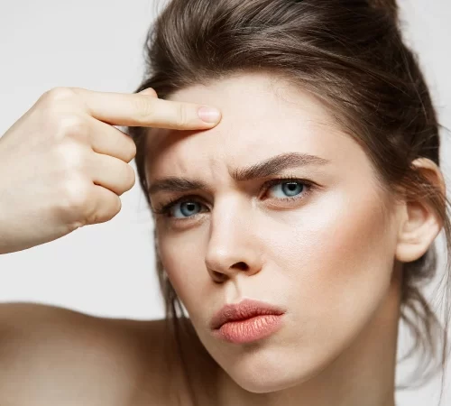 forehead lowering surgery