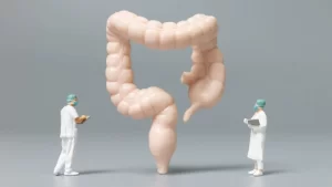 colon cancer