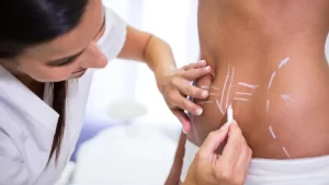 Lipomatik ve Liposuction Farkları