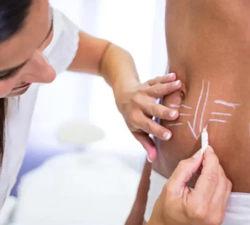 Lipomatik ve Liposuction Farkları