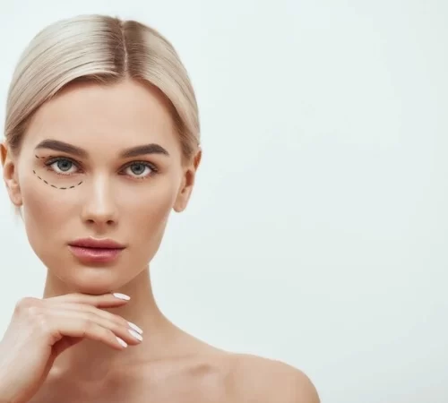 blepharoplasty-in-turkey blepharoplasty in turkey