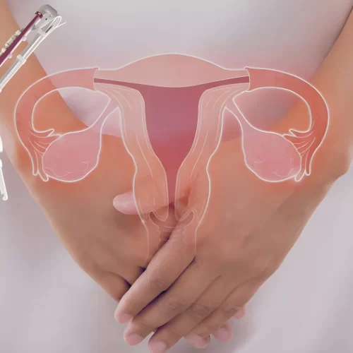 genital siğil