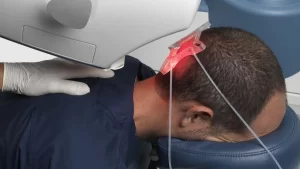 Lazerle Saç Tedavisi: Saç Lazeri