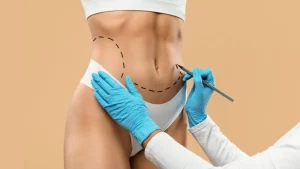 mini tummy tuck in turkey