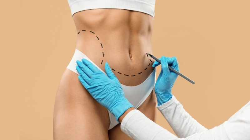 mini tummy tuck in turkey