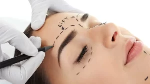 عملية رفع الحاجب الصدغية في تركيا