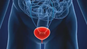 Bladder augmentation