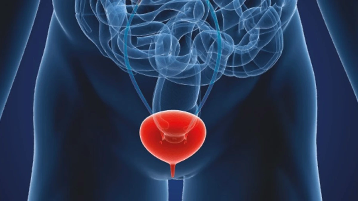 Bladder augmentation