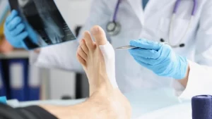 Bunion surgery in turkey