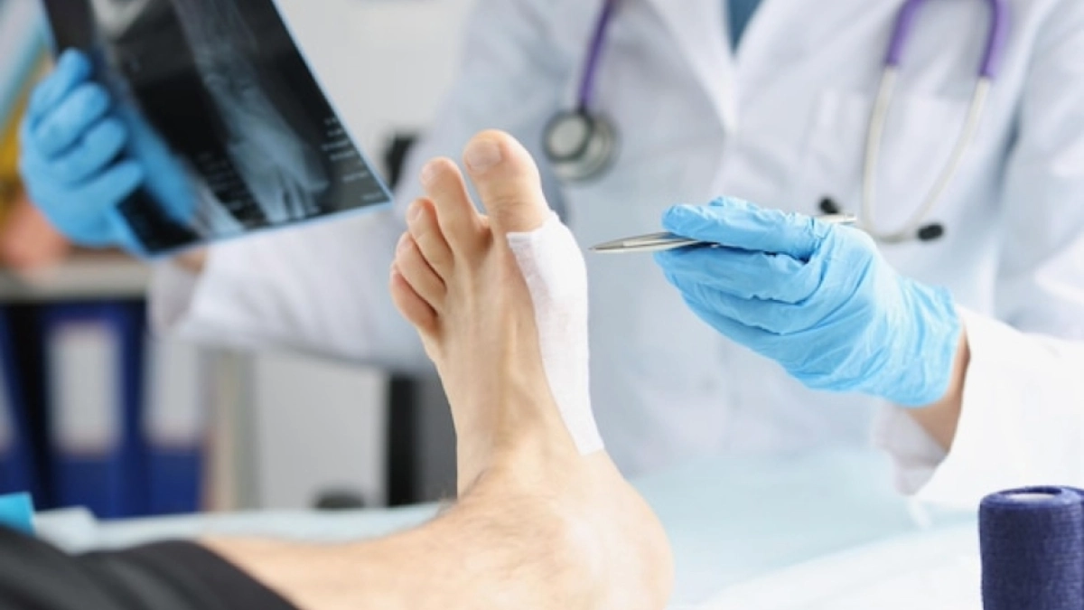 Bunion surgery in turkey