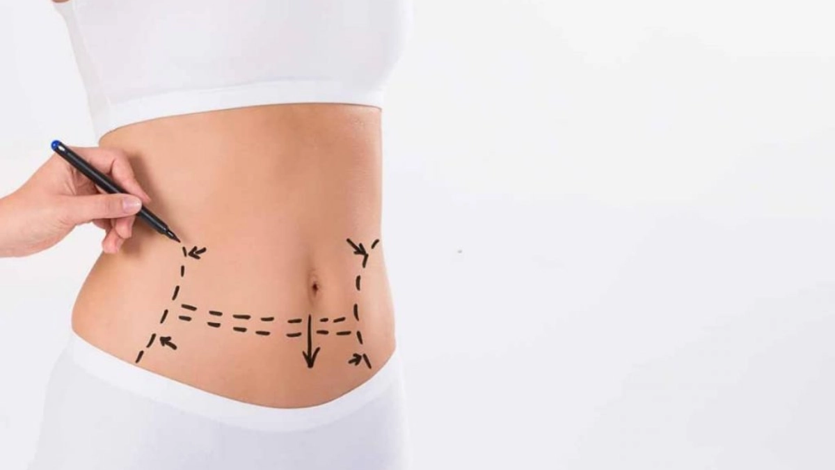 تامی تاک در ترکیه