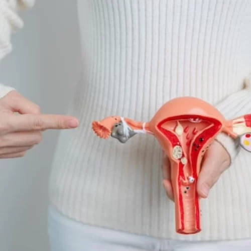 Hysterectomy for Womb Cancer