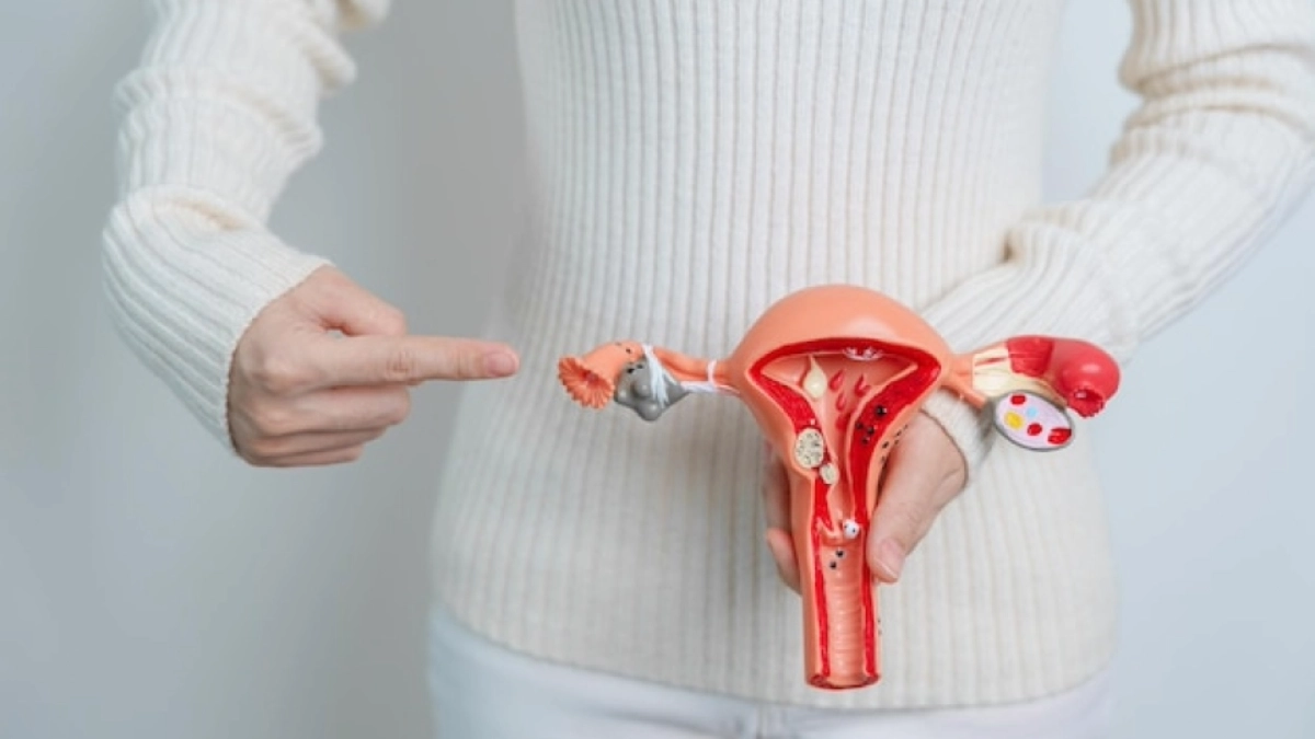 Hysterectomy for Womb Cancer