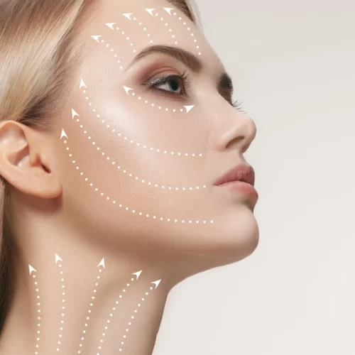 Operația de lifting facial (întinerire facială) în Turcia