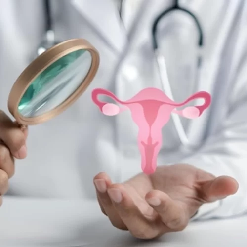 LEGAREA TROMPELOR UTERINE (LIGATURA TROMPELOR)