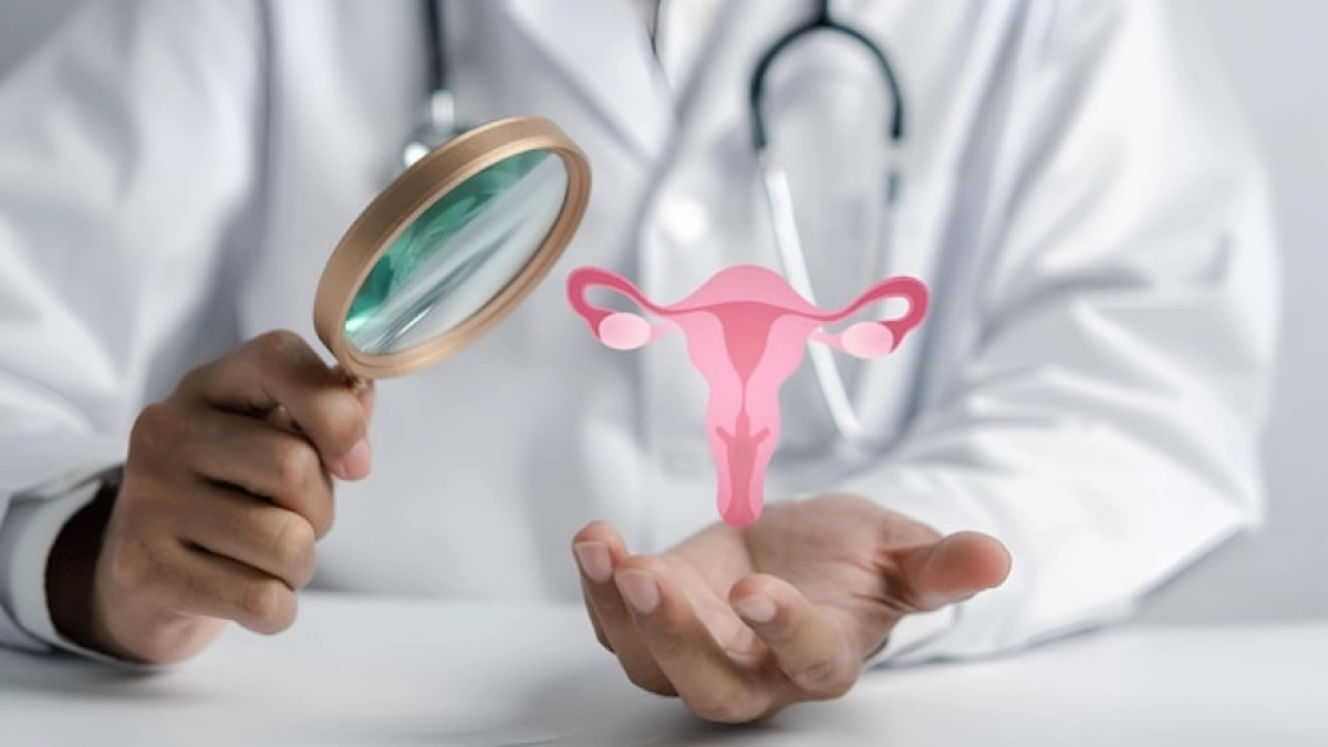 LEGAREA TROMPELOR UTERINE (LIGATURA TROMPELOR)