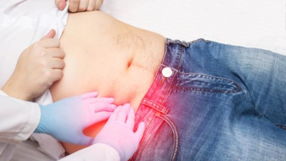 جراحی فتق کشاله‌ ران در ترکیه