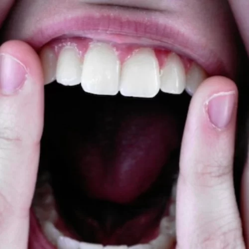 oral-cancer-treatment-in-turkey Oral Cancer Treatment in Turkey
