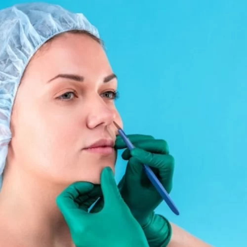 revision-rhinoplasty-turkey Revision Rhinoplasty Turkey