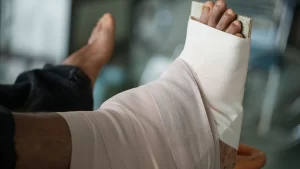 فیوژن مچ پا در ترکیه