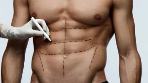 İstanbul’da Karın Kası