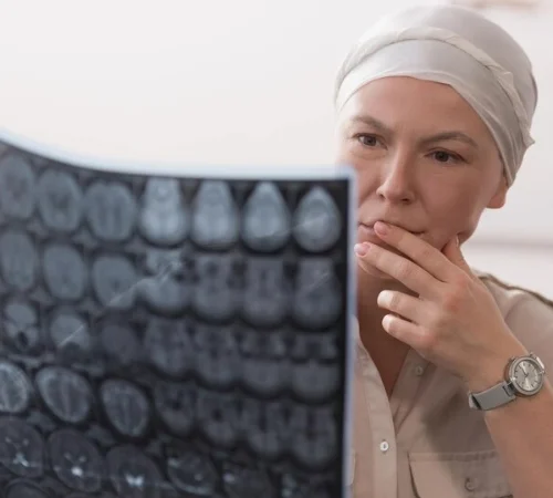 Онкологичен