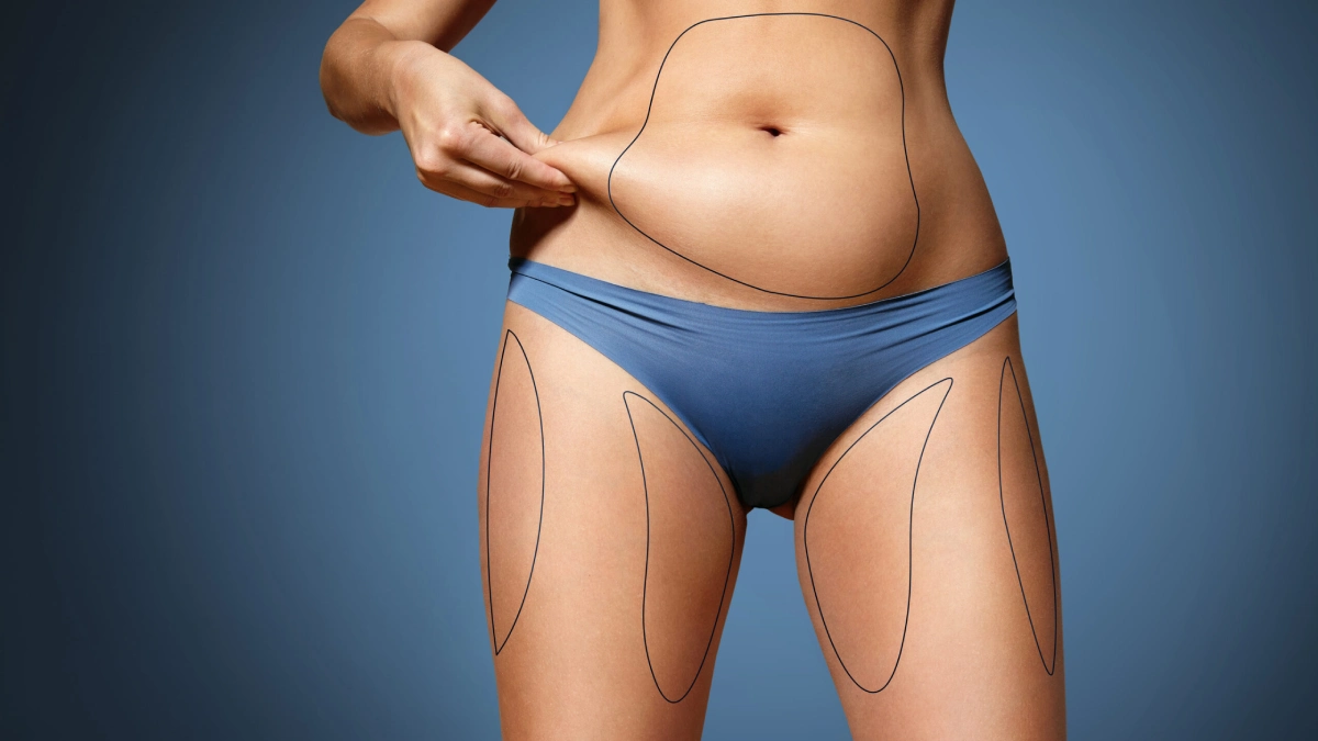 لیپوساکشن، بادی کانتورینگ