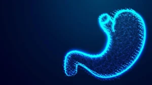 Duodenal Switch Surgery in Turkey