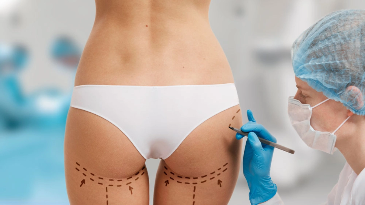 Ernährung nach BBL: So hält das Ergebnis länger