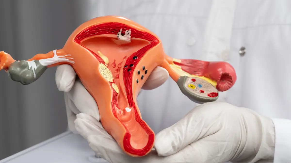 Histeroskopik Myom Çıkarılması