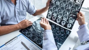 Tratamentul accidentului vascular cerebral în Turcia