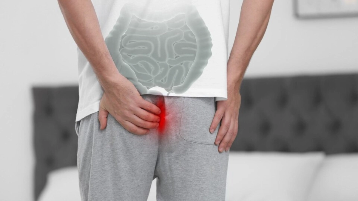 Tratamentul Hemoroizilor în Turcia