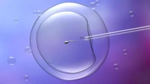 Инвитро оплождане (IVF) в Турция