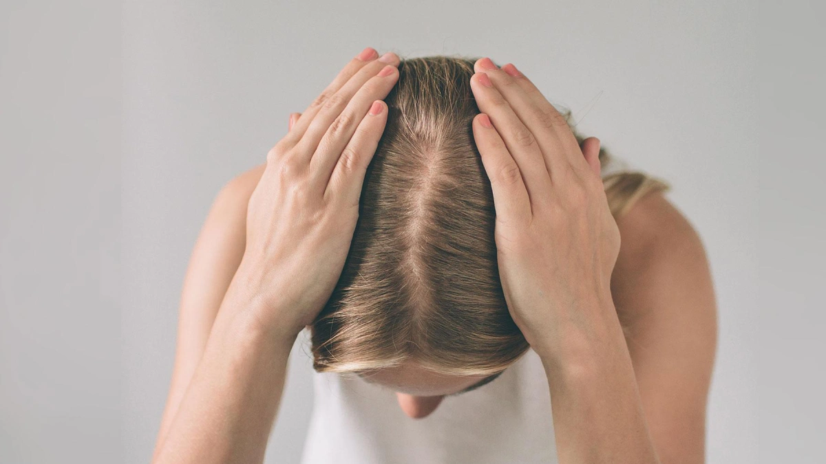 نکات مهم قبل از انجام کاشت مو