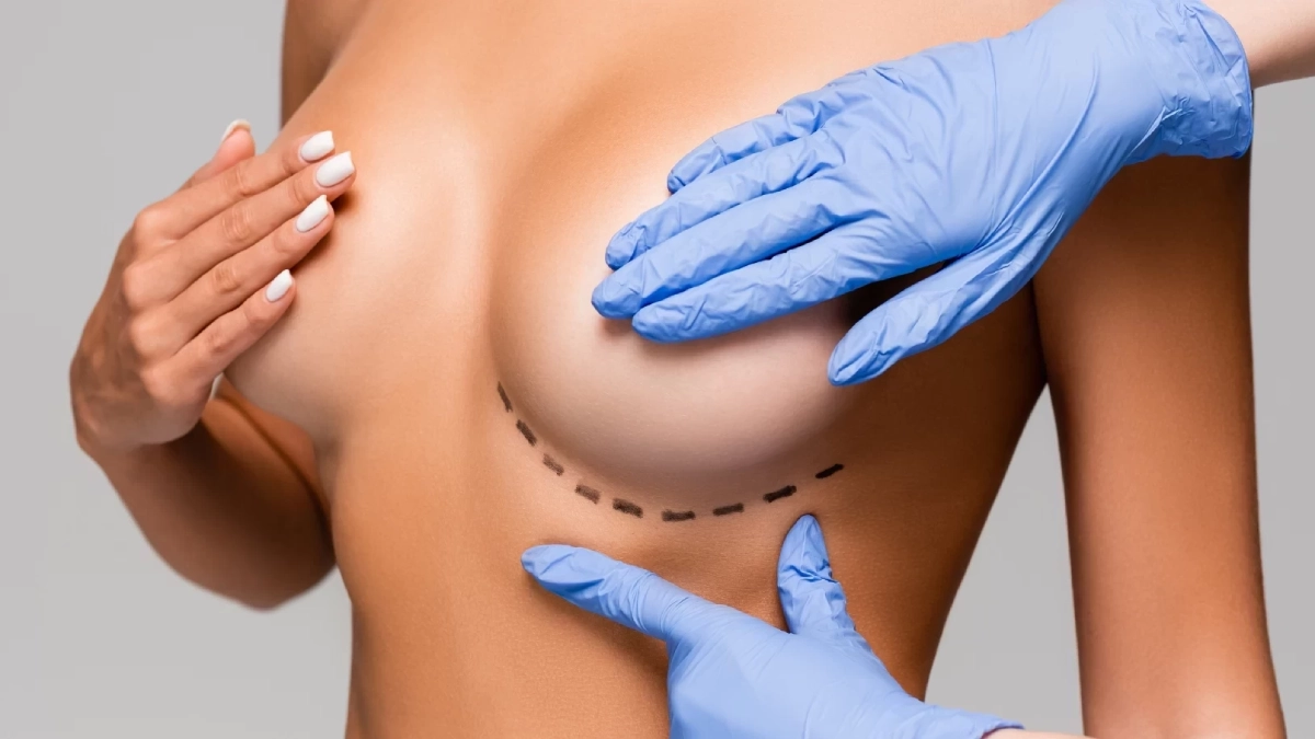 همه‌چیز درباره جراحی زیبایی سینه