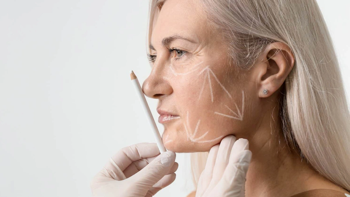 چرا لیفت صورت در ترکیه؟ مزایا و هزینه‌ها