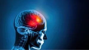 Лечение на мозъчни тумори в Турция