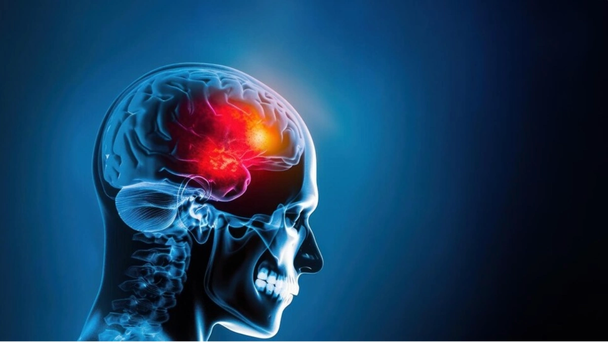 Лечение на мозъчни тумори в Турция