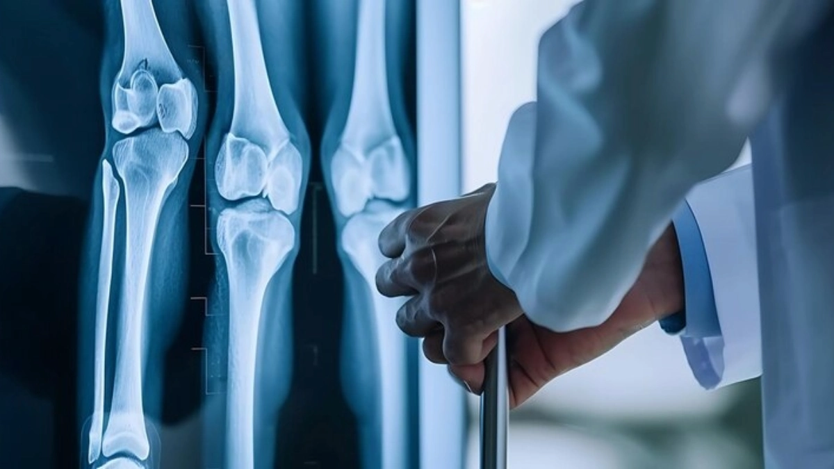 Ортопедична онкология в Турция