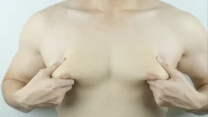 Gynäkomastie behandeln: Die dauerhafte Lösung bei Männerbrust