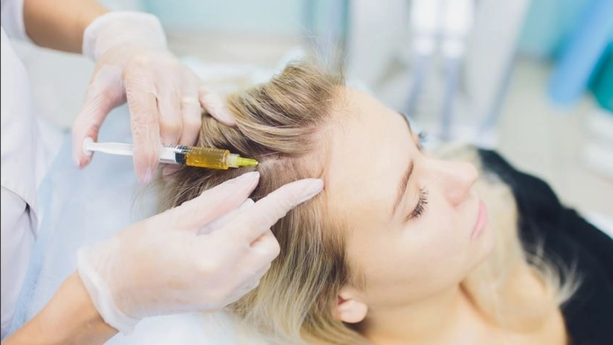 Haarausfall behandeln mit PRP und Mesotherapie